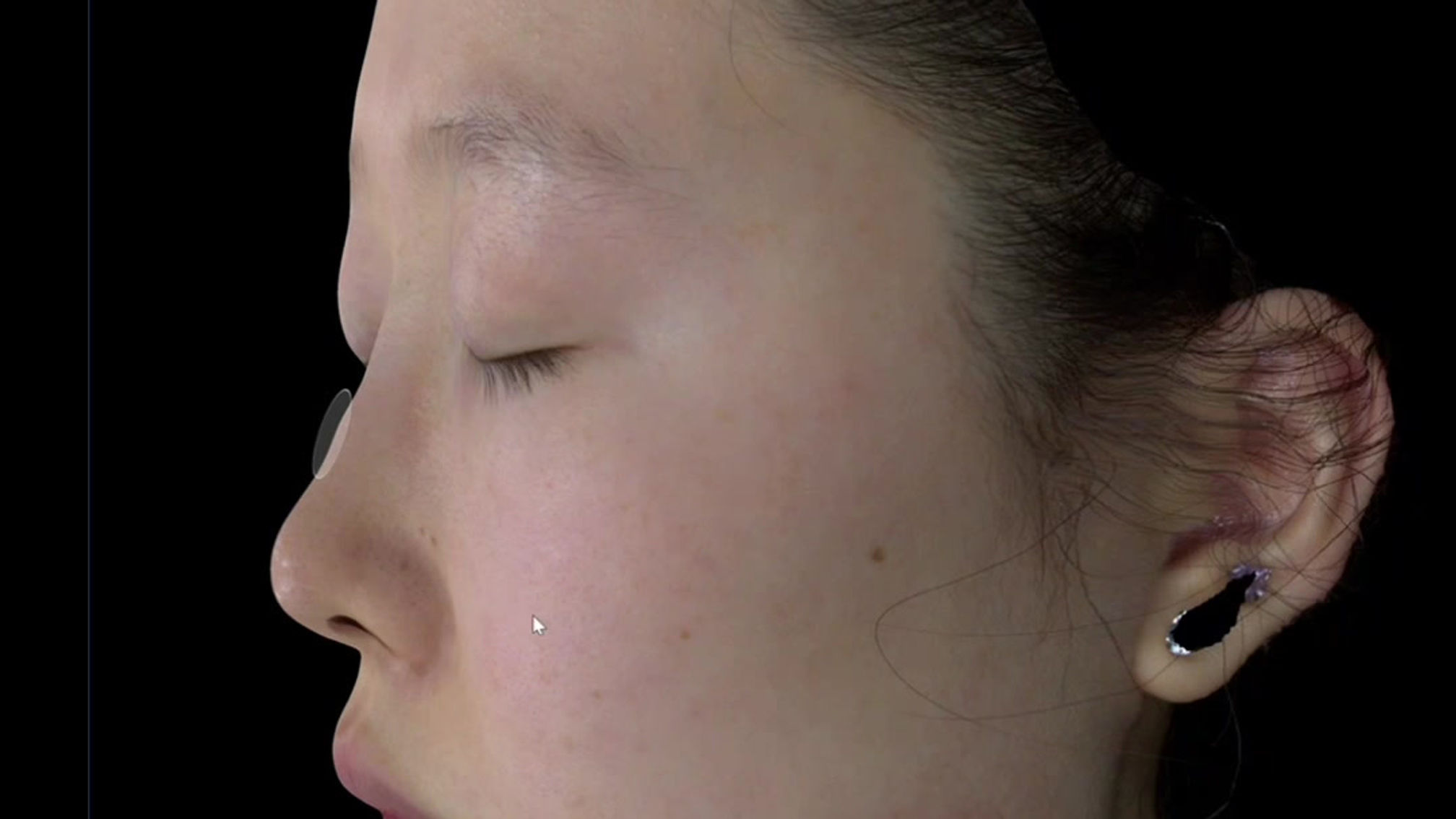 AI 3D Skinvista Analyzer